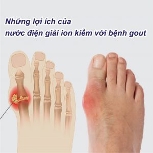 5 Tác dụng của nước điện giải ion kiềm hỗ trợ và giảm biến chứng bệnh gout
