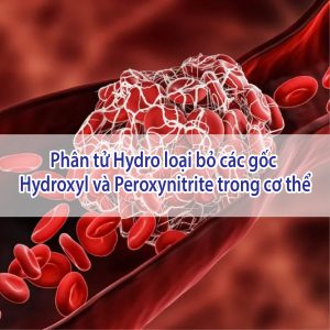 Phân tử hydro loại bỏ các gốc hydroxyl và Peroxynitrite trong cơ thể